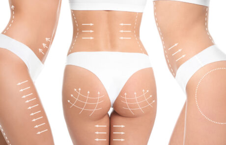 cirugias-tratamientos-fisioestetica-corporal-mujer-body-massage-by-jose-sanz