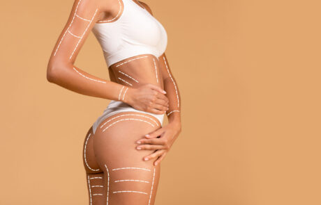liposuccion-tratamientos-fisioestetica-corporal-mujer-body-massage-by-jose-sanz