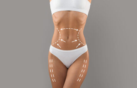 remodelacion-silueta-tratamientos-fisioestetica-corporal-mujer-body-massage-by-jose-sanz