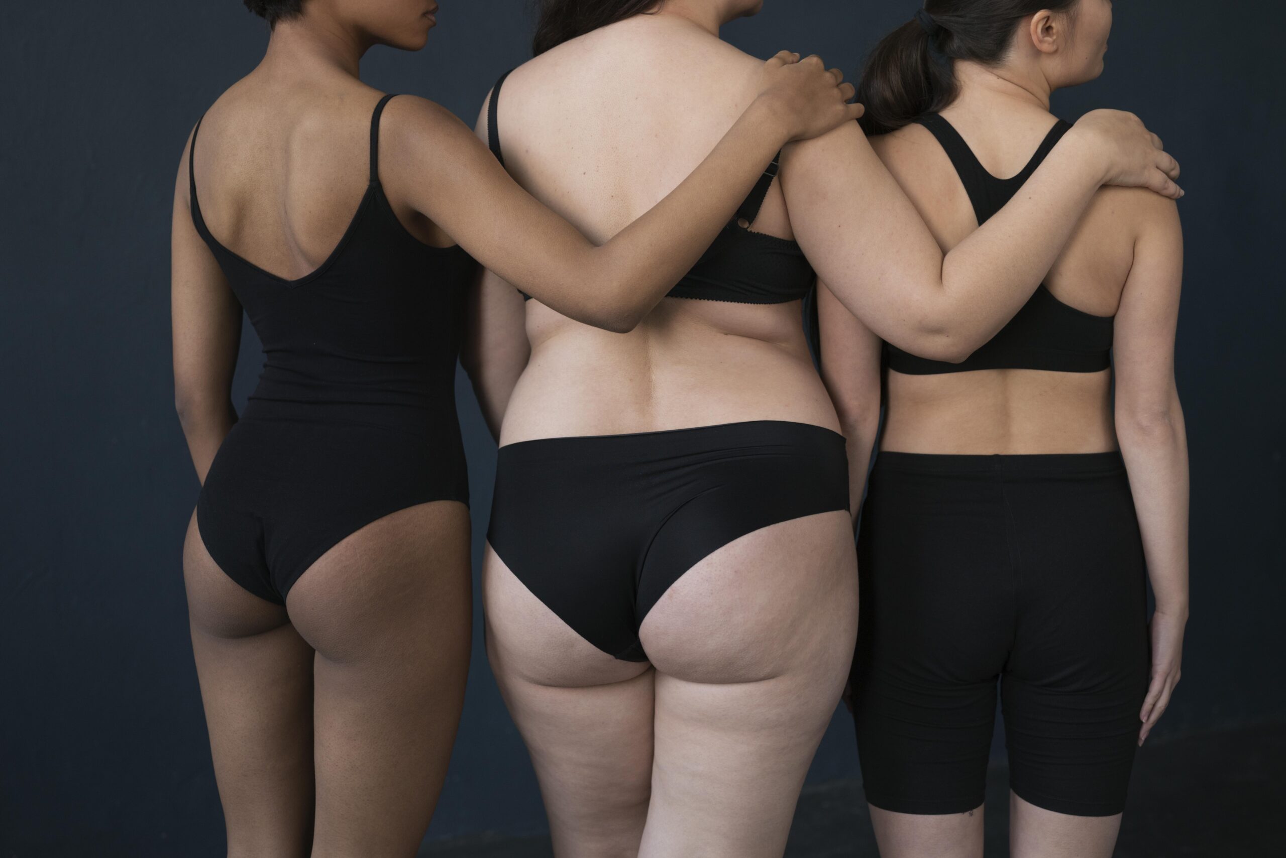 evolucion-lipedema-body-massage-jose-sanz-san-sebastian-reyes evolucion-lipedema-body-massage-jose-sanz-san-sebastian-reyes